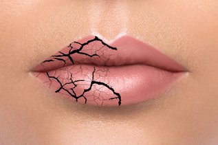 What Causes Dry Mouth at Night?