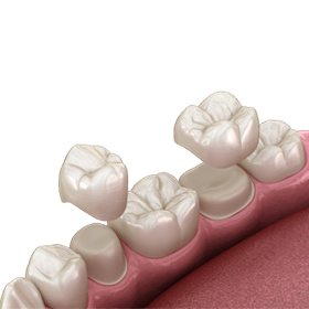 crowns_ill_2_280x280.png