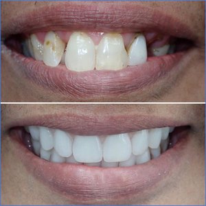 Smile Gallery Image
