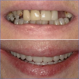 Smile Gallery Image