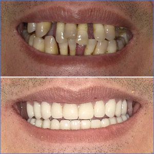 Smile Gallery Image