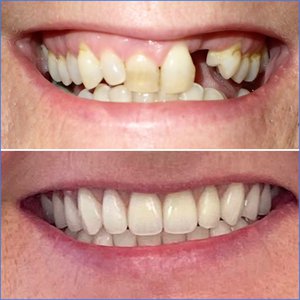 Smile Gallery Image