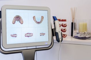 iTero Scanner