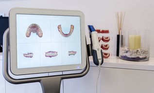 iTero Scanner