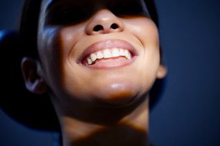 Patient smiling after professional teeth whitening treatment at North York Smile Centre in North York Toronto